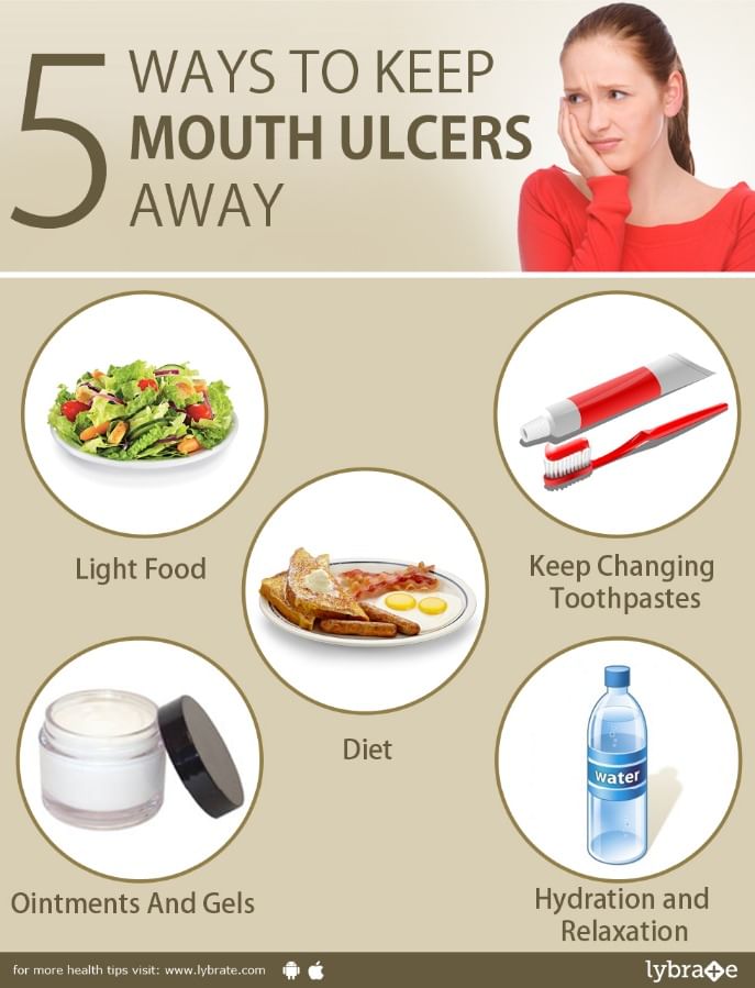 5 ways to keep Mouth Ulcers away