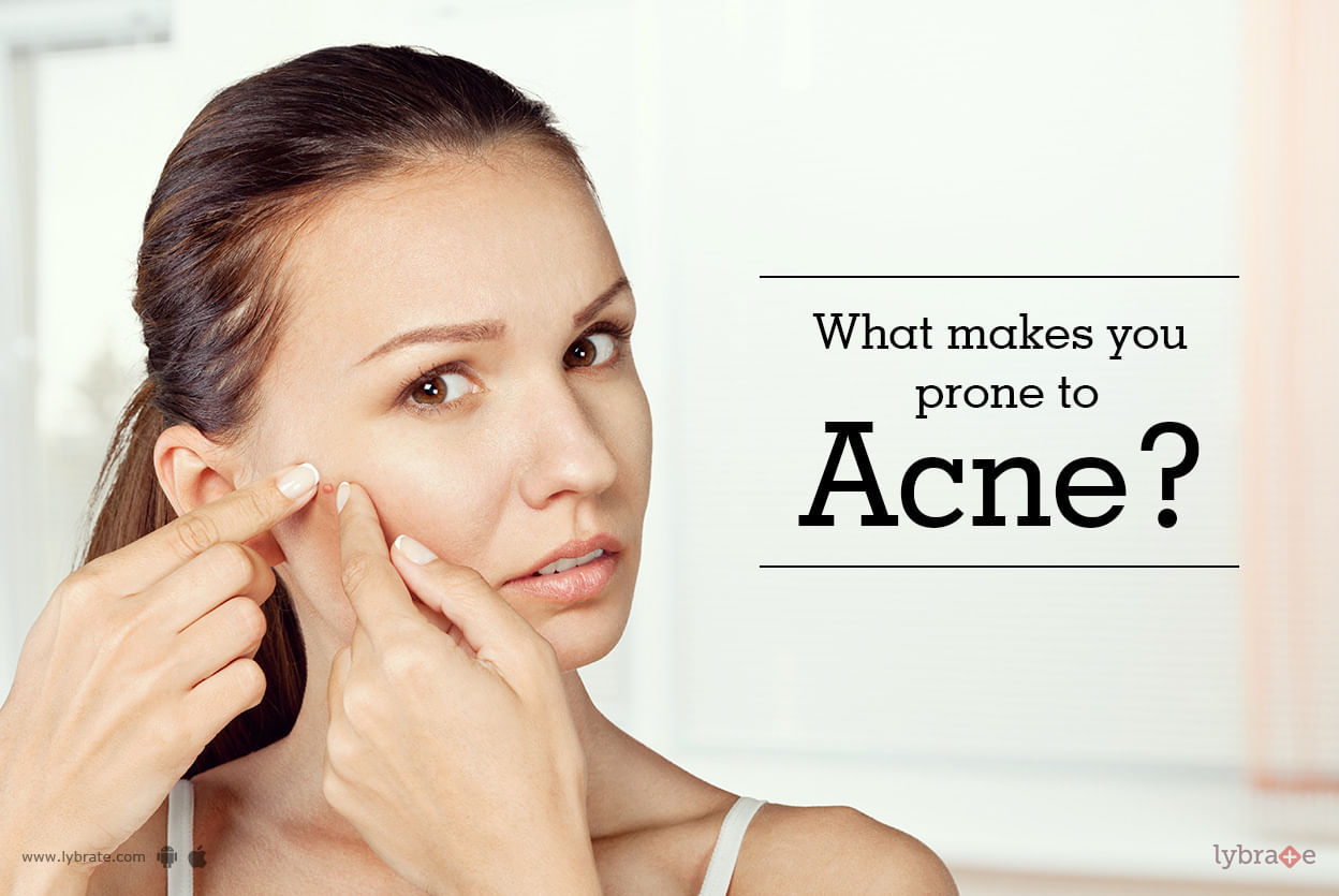 What Makes You Prone to Acne?