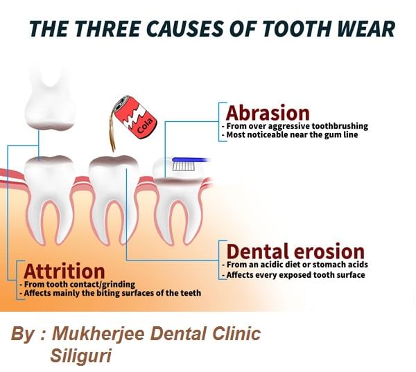 Dental Health