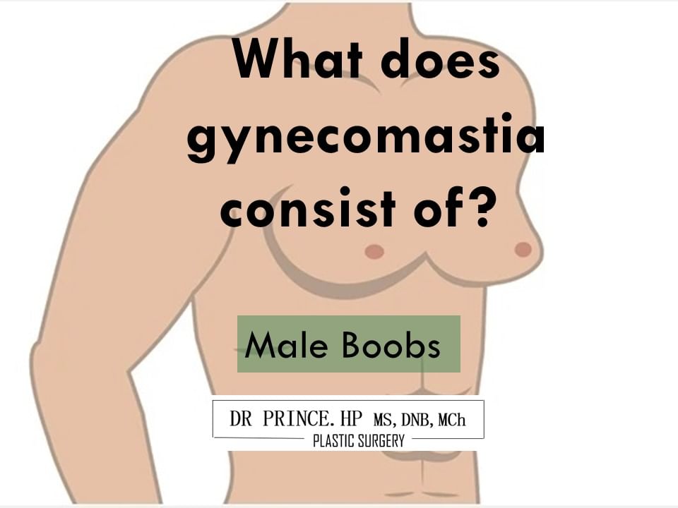 What does male boobs (gynecomastia) consist of?