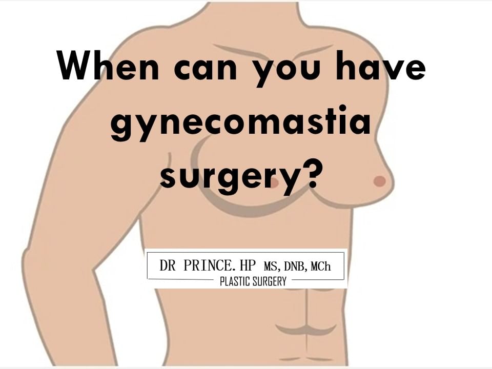 when can you have gynecomastia surgery?