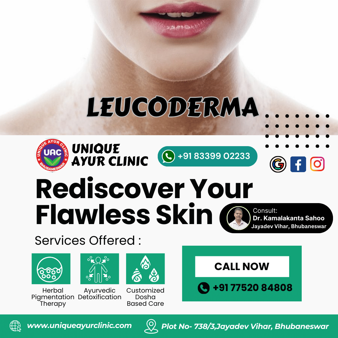 Effective Leucoderma Treatment in Bhubaneswar