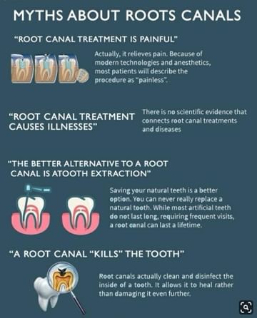 Debunking Myths Around Root Canal Treatment!
