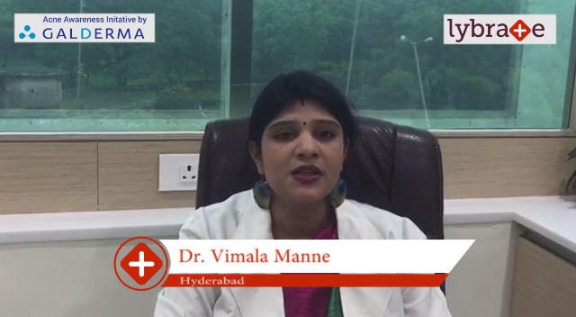 Lybrate | Dr. Vimala Manne speaks on IMPORTANCE OF TREATING ACNE EARLY