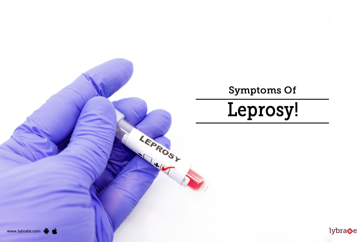 Symptoms Of Leprosy!