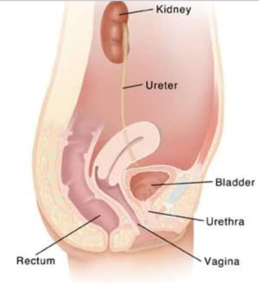 Urinary Tract Infections(UTI) In Women!