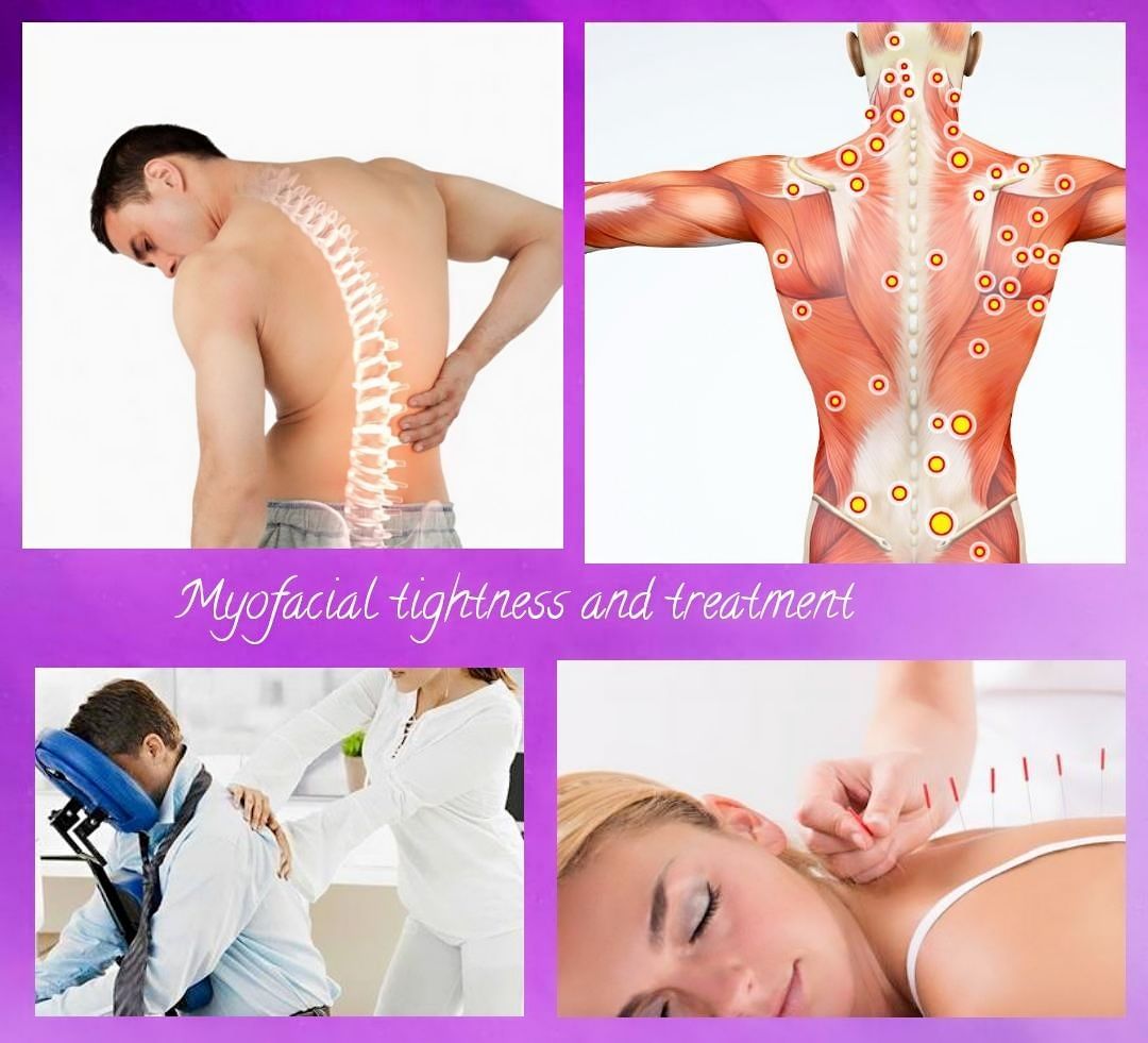 Back Pain Can Be Due To Myofascial Pain Syndrome!