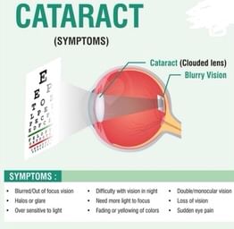 Symptoms Of Cataract!