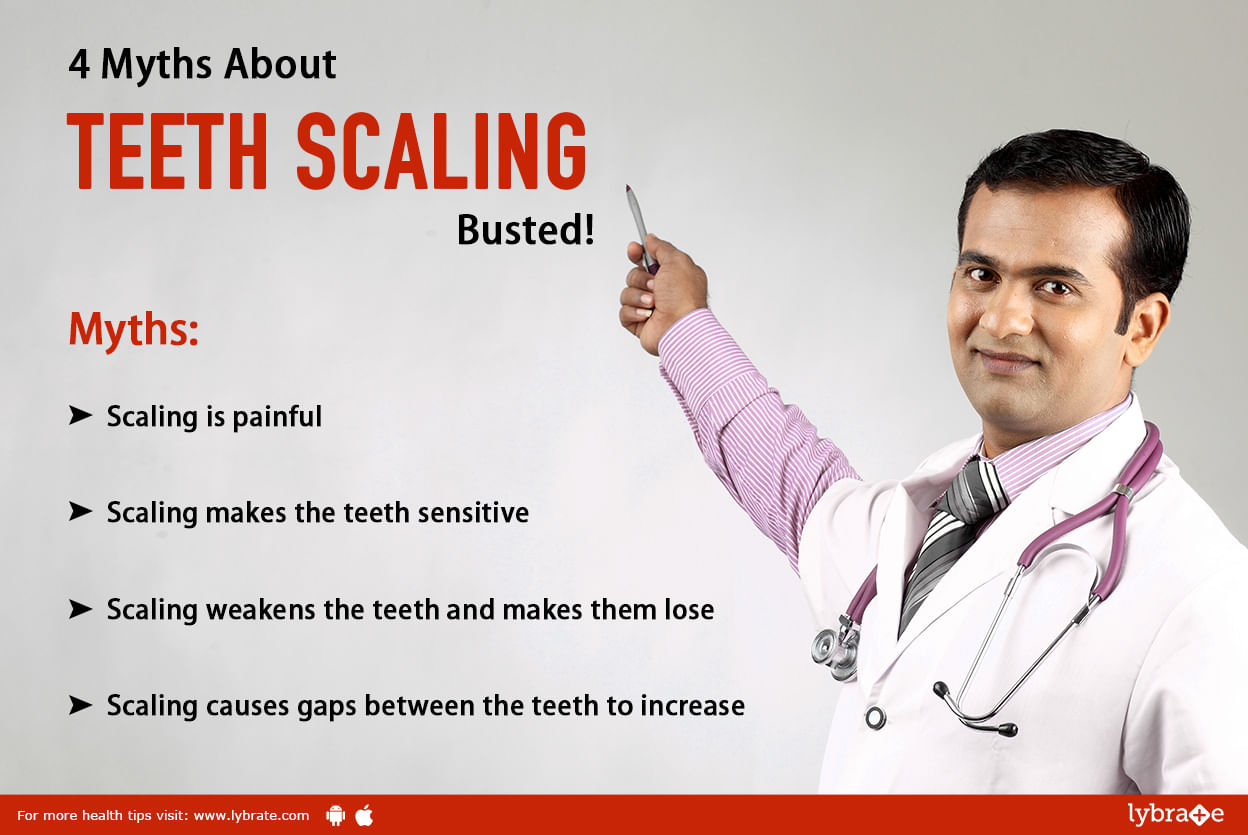 4 Myths About Teeth Scaling - Dental Myth Busted