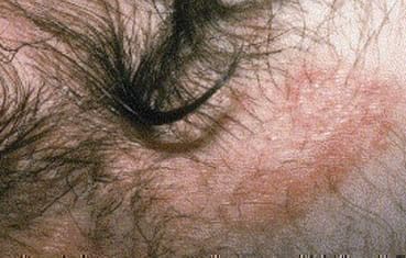banner-image