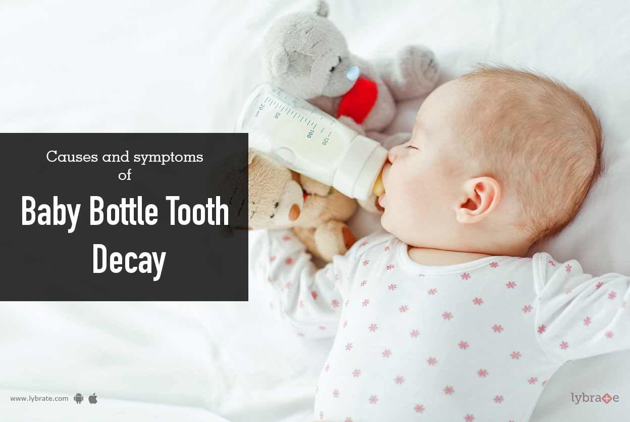 Causes and symptoms of Baby Bottle Tooth Decay