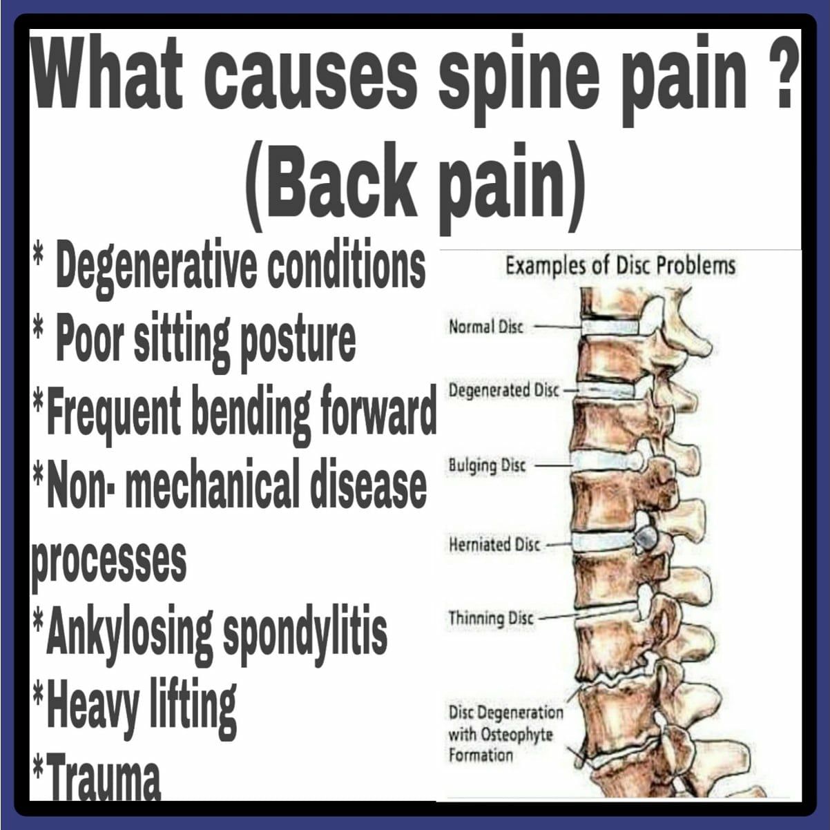 Low Back Pain -  Should Know!