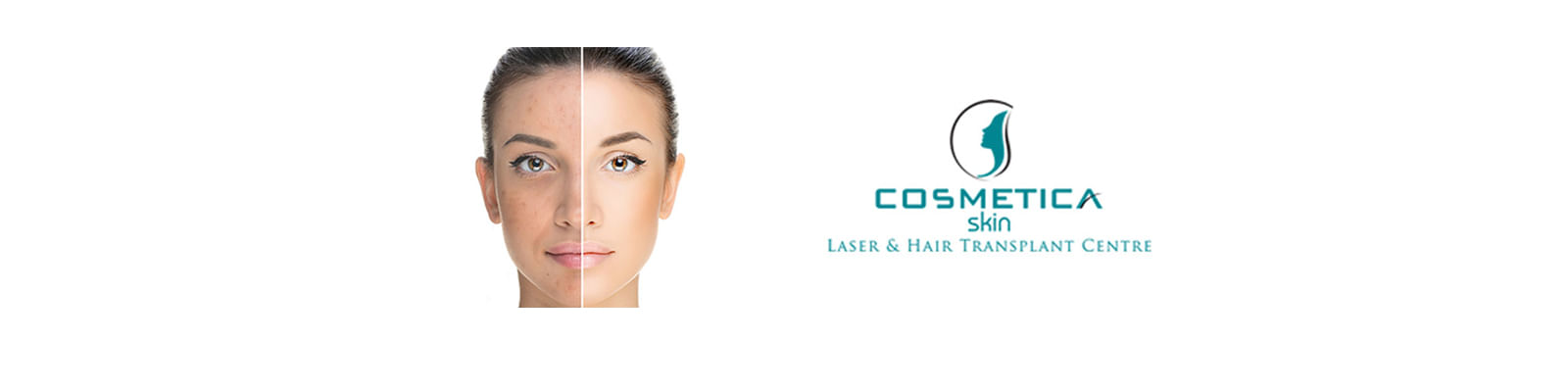 Cosmetica Skin Laser & Hair Transplant Centre