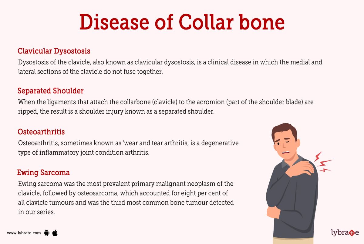 Collar Bone Human Anatomy Image Function Diseases And Treatments 2810