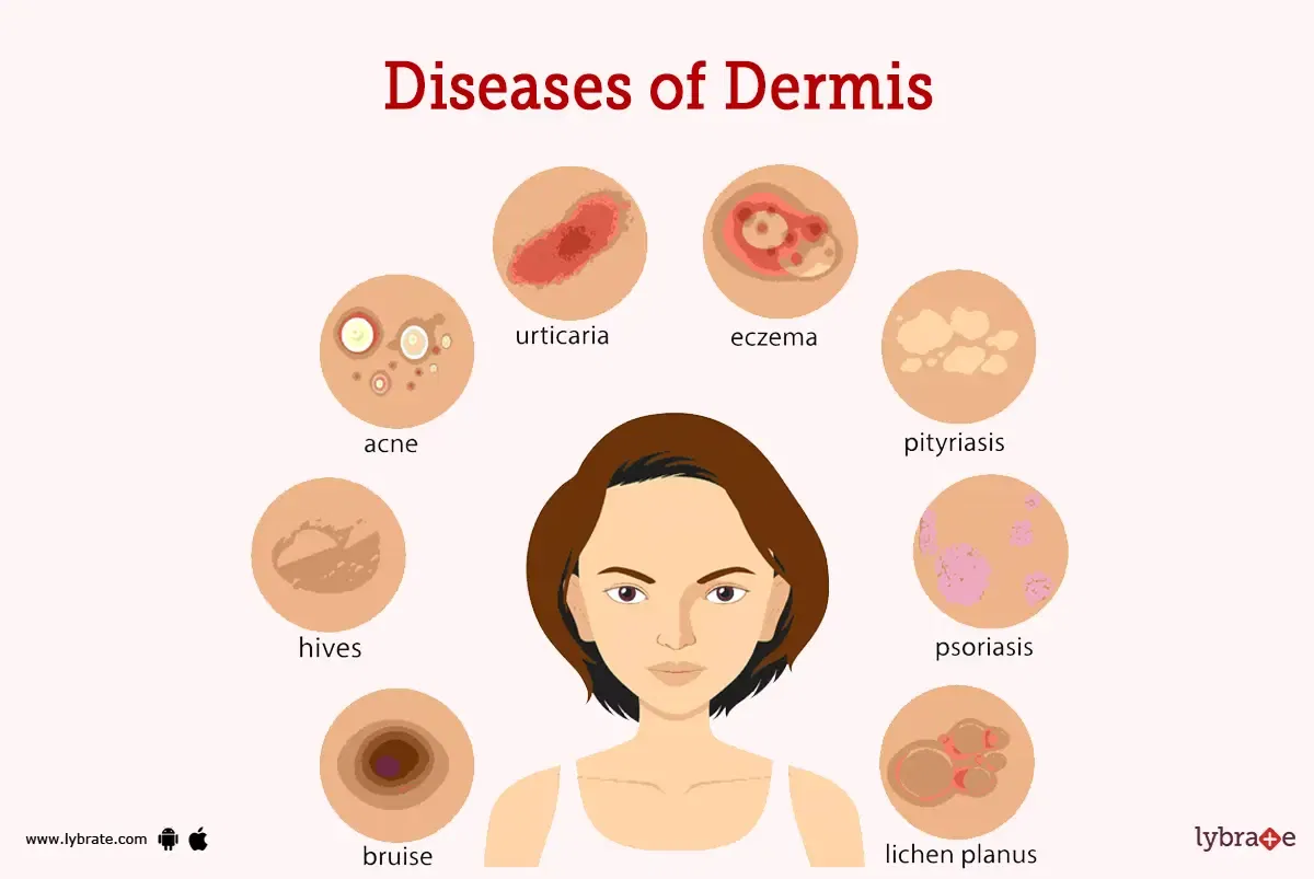 Dermis (Human Anatomy): Image, Functions, Diseases and Treatments