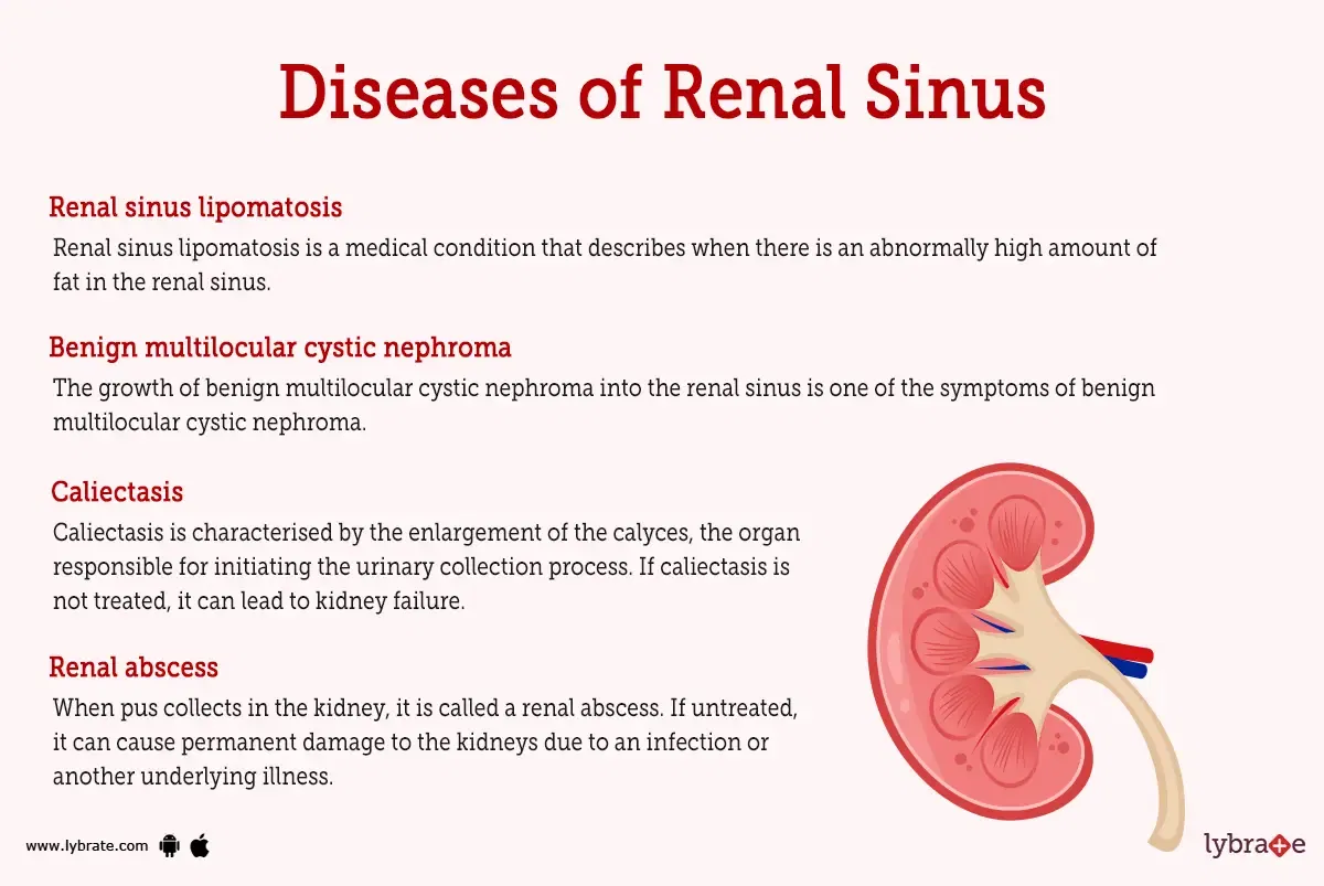 Renal Sinus (Human Anatomy): Image, Functions, Diseases and Treatments