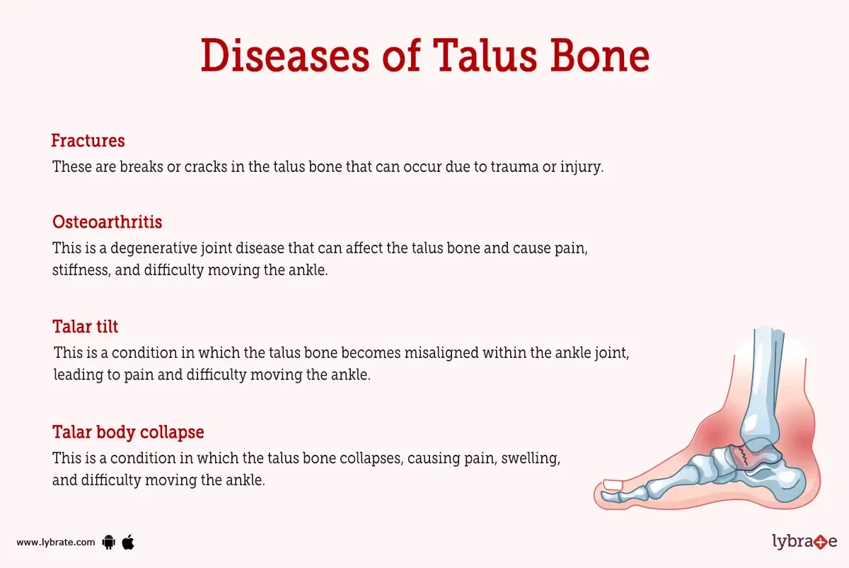 Talus Bone Human Anatomy Image Functions Diseases And Treatments