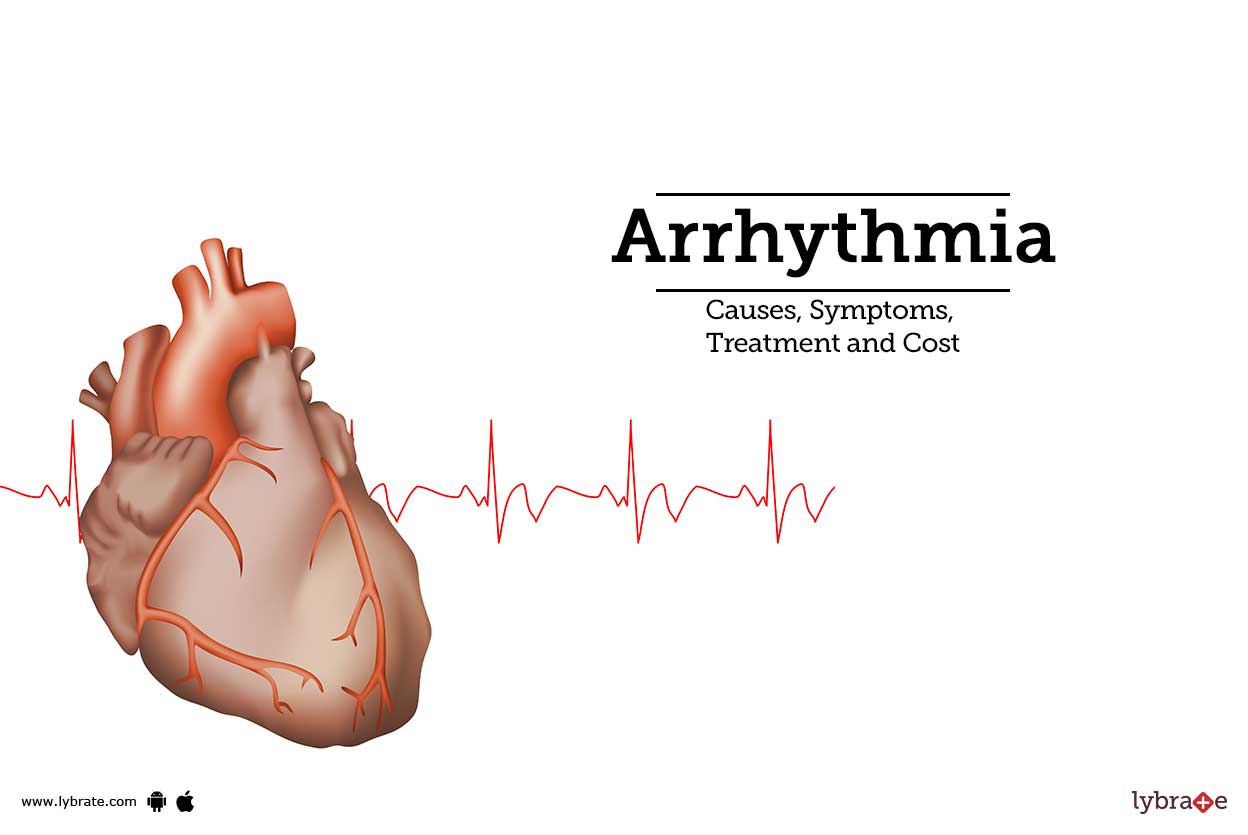 Arrhythmia Causes, Symptoms, Treatment and Cost
