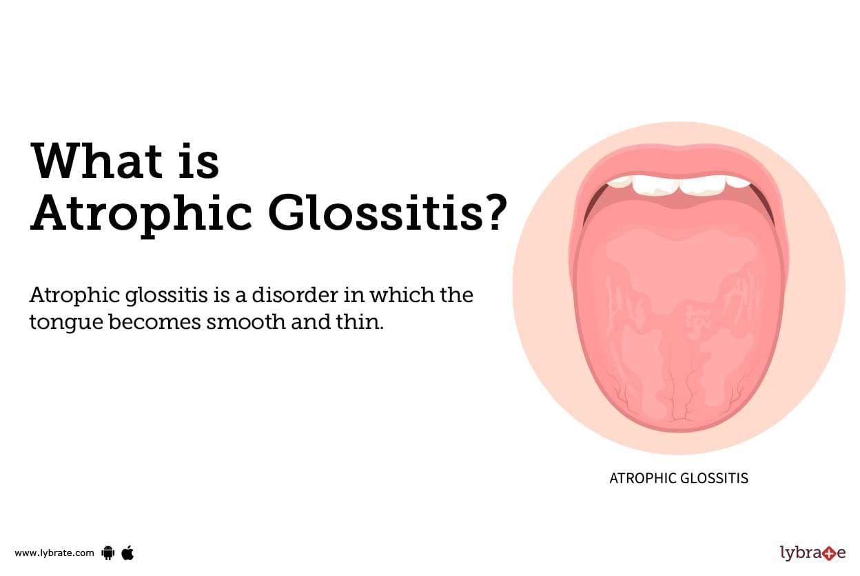 Atrophic Glossitis Causes Symptoms Treatment And Cost