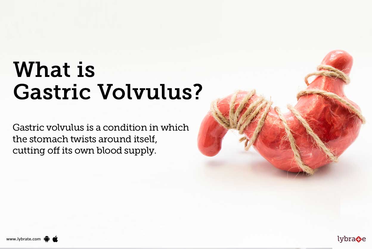 What Is Volvulus Causes Symptoms Treatment Diagnosis vrogue.co