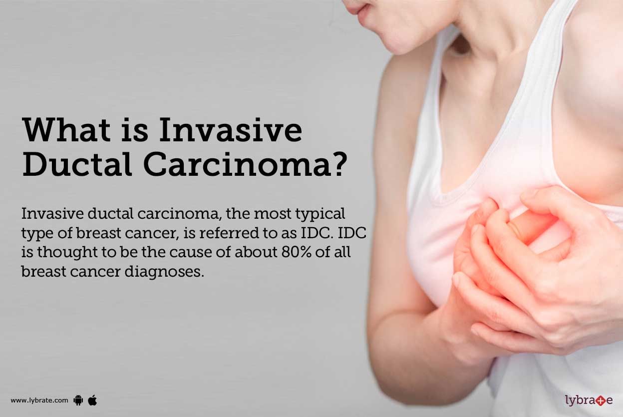 invasive-ductal-carcinoma-causes-symptoms-treatment-and-cost