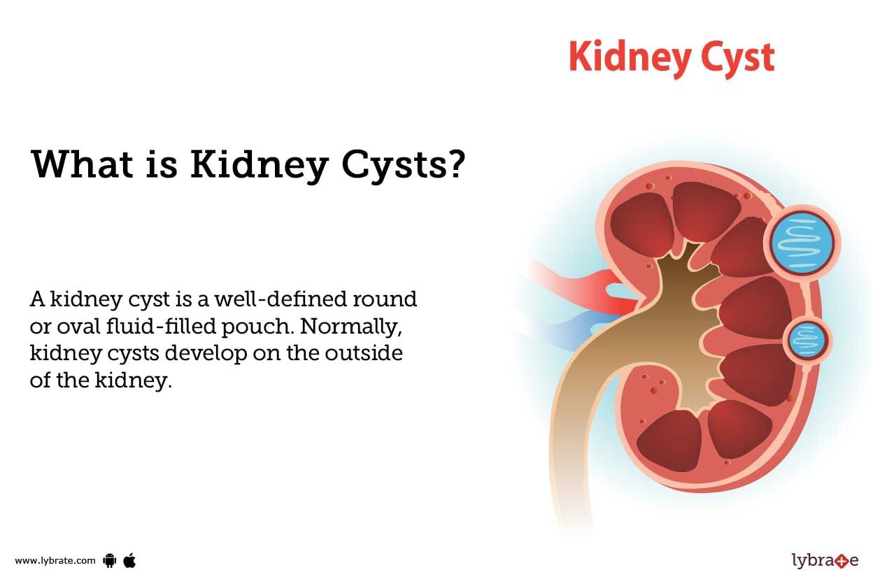 Kidney Cysts Causes Symptoms Treatment And Cost