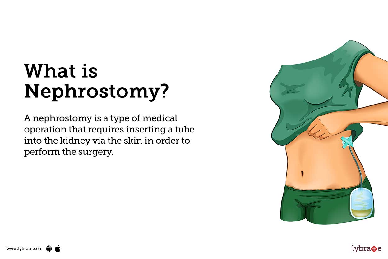 Nephrostomy Causes, Symptoms, Treatment and Cost