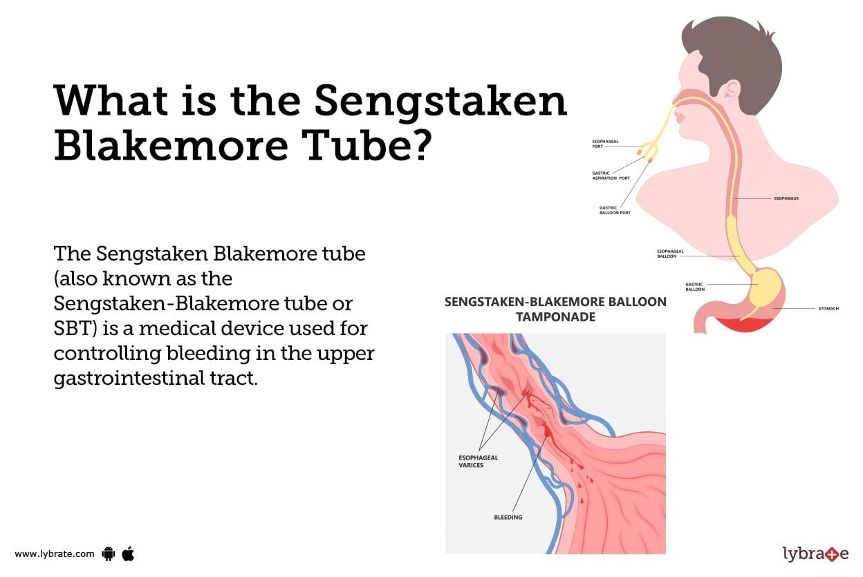 Sengstaken Blakemore Tube Causes Symptoms Treatment And Cost