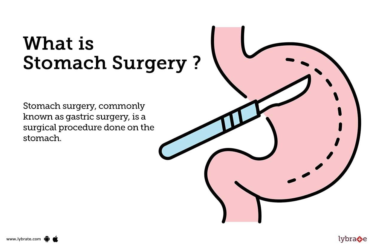 stomach-surgery-causes-symptoms-treatment-and-cost