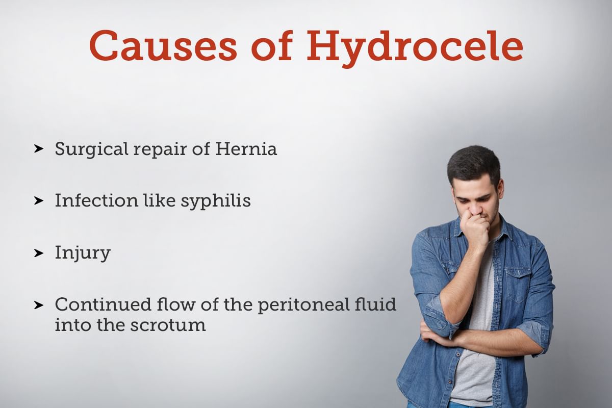 hydrocele-infection-symptoms-causes-diagnosis-treatments-and