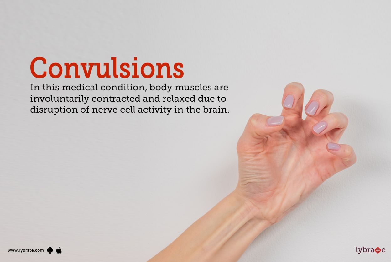 Convulsions Symptoms, Causes, Treatment, Cost, and Side Effects