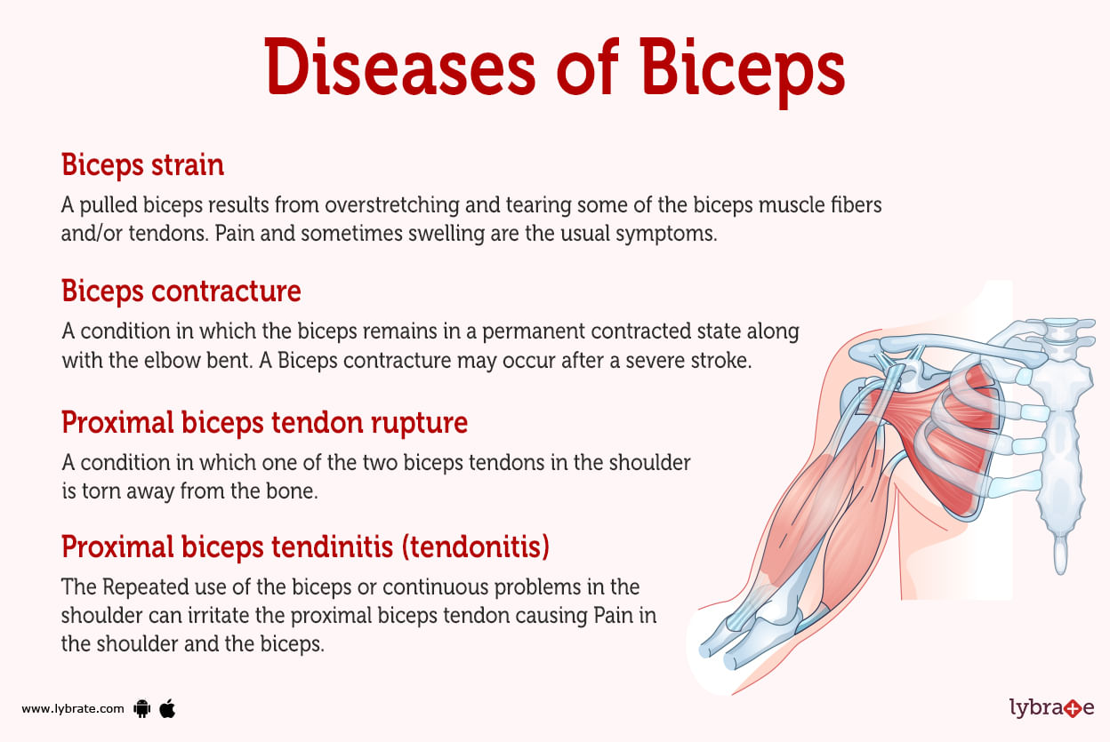 Biceps Human Anatomy Picture Function Diseases Tests And Treatments 2309