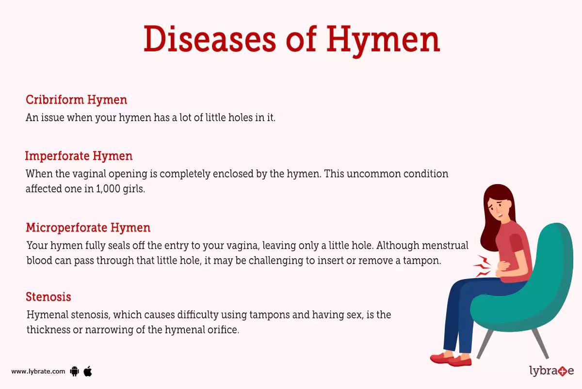 Hymen Human Anatomy Picture Functions Diseases And Treatments