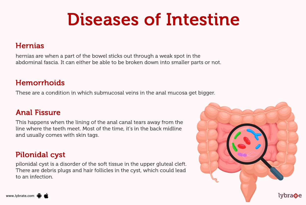 intestines-anatomy-picture-function-location-conditions