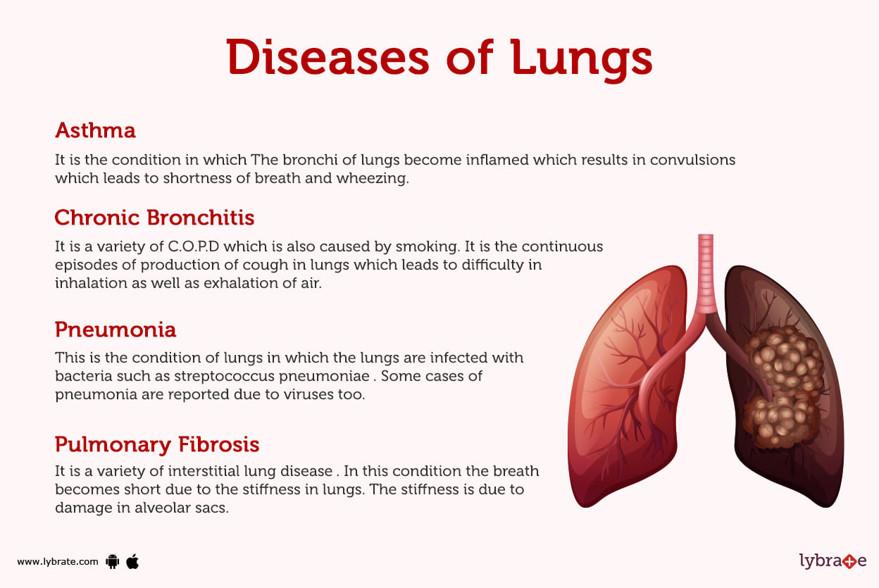 Lungs Human Anatomy Picture Function Diseases Treatment And More 