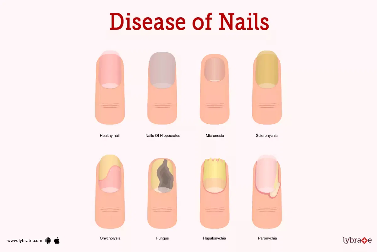 Nails (Human Anatomy): Picture, Functions, Diseases, and Treatments