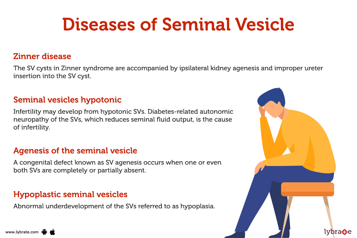 Seminal Vesicle (Human Anatomy) Picture , Functions, Diseases and