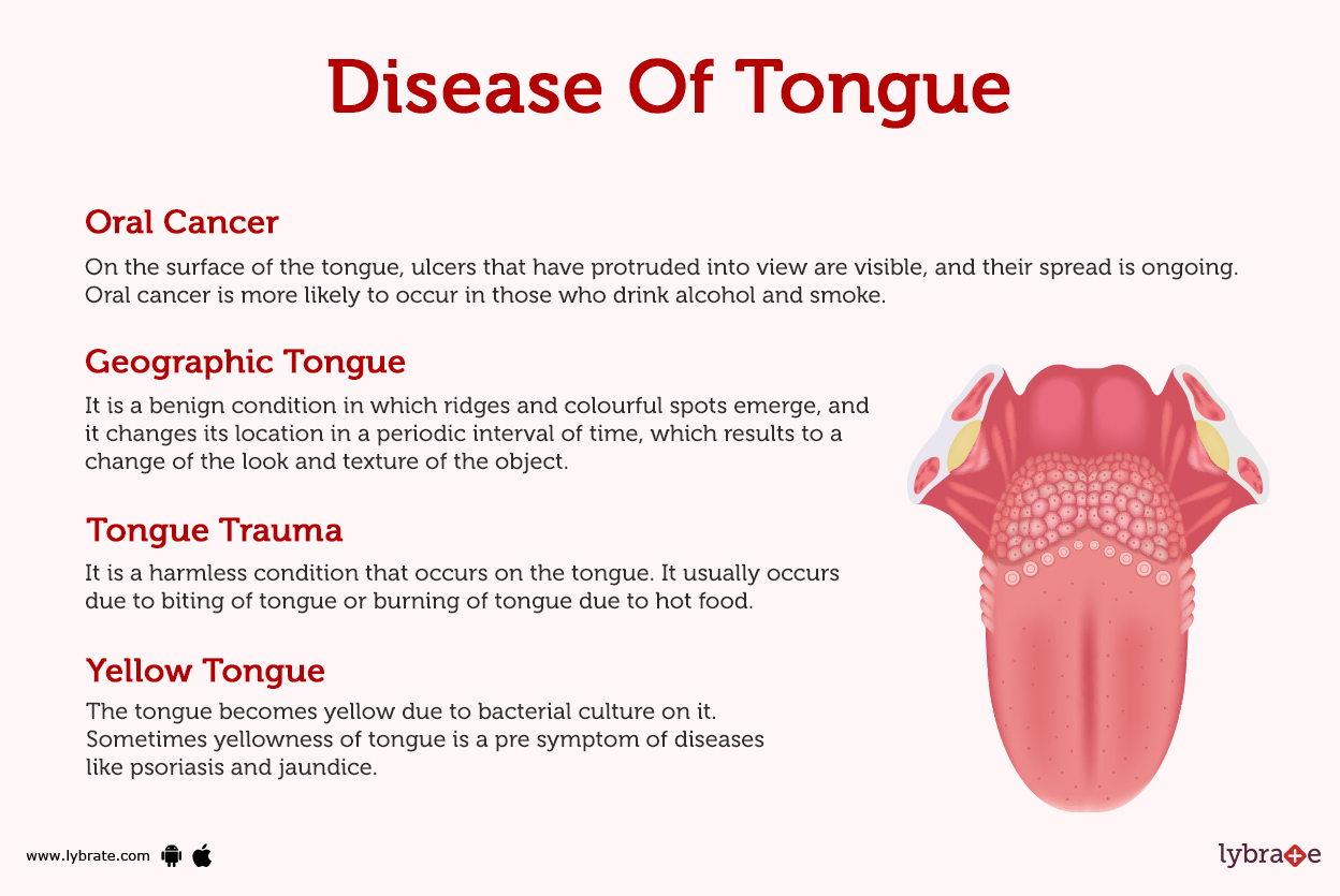 Tongue (Human Anatomy) Image, Function, Definition, Problems, and More