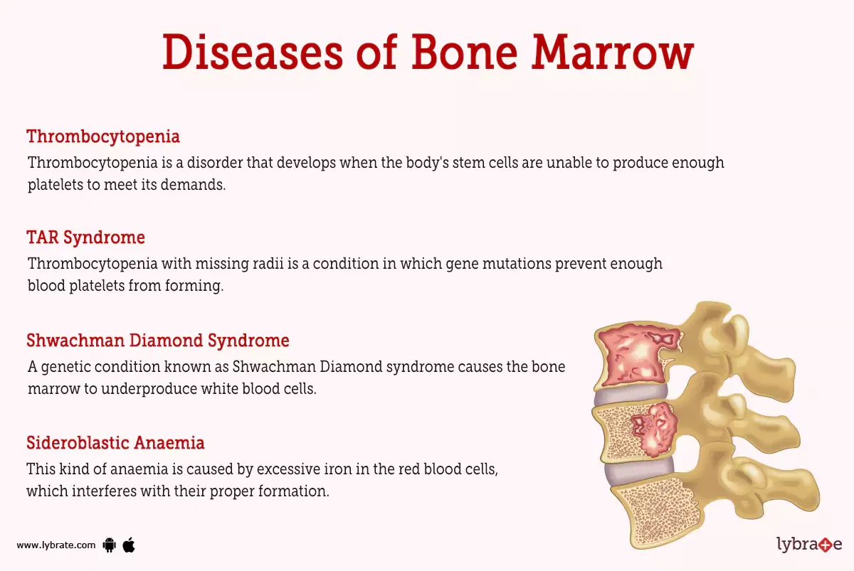 bone-marrow-physiopedia-vrogue-co