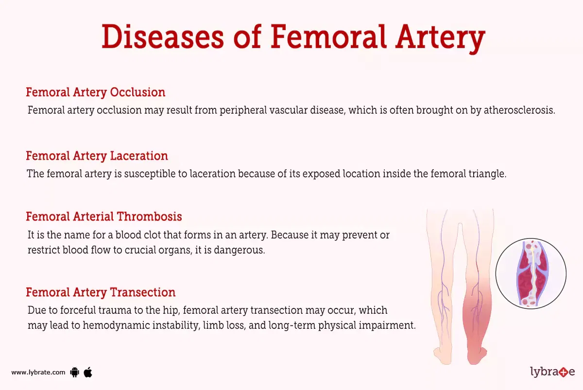 Femoral Artery Human Anatomy Image Functions Diseases And Treatments