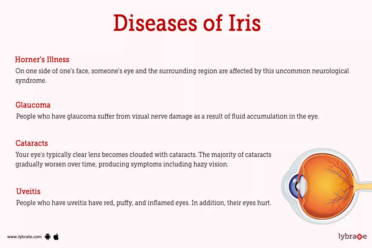 Iris (Human Anatomy) Image, Functions, Diseases and Treatments