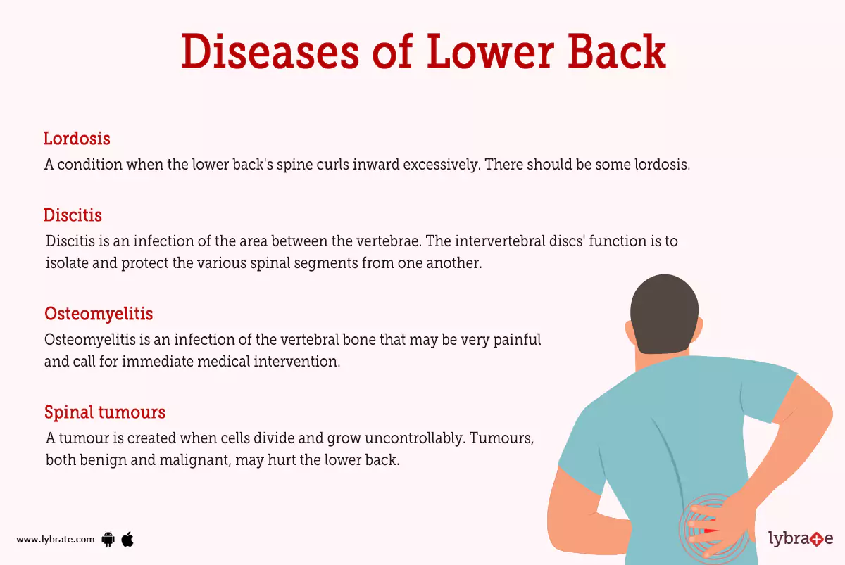Lower Back (Human Anatomy): Image, Function, Diseases, and Treatments