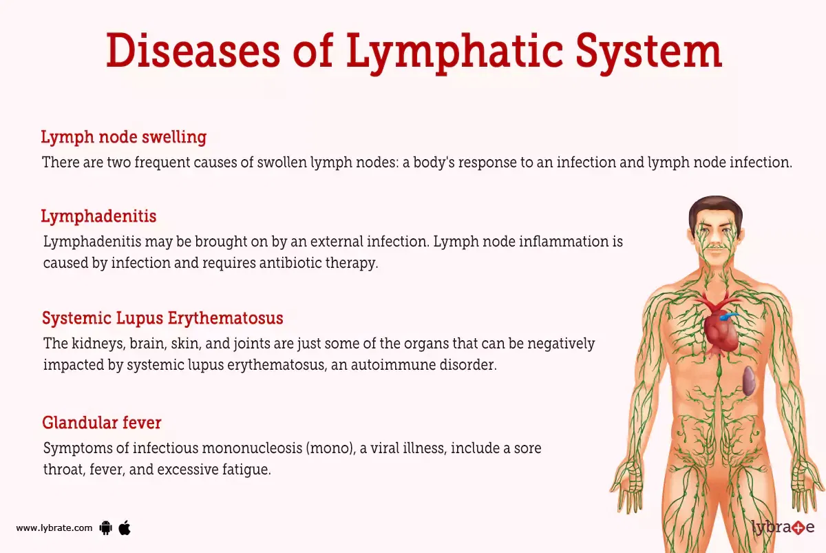 Lymphatic System (Human Anatomy): Picture, Functions, Diseases, And ...