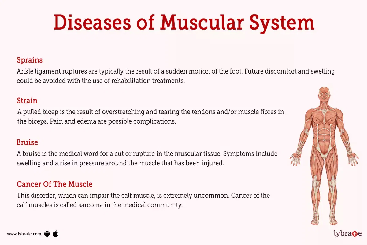 muscular-system-human-anatomy-picture-functions-diseases-and