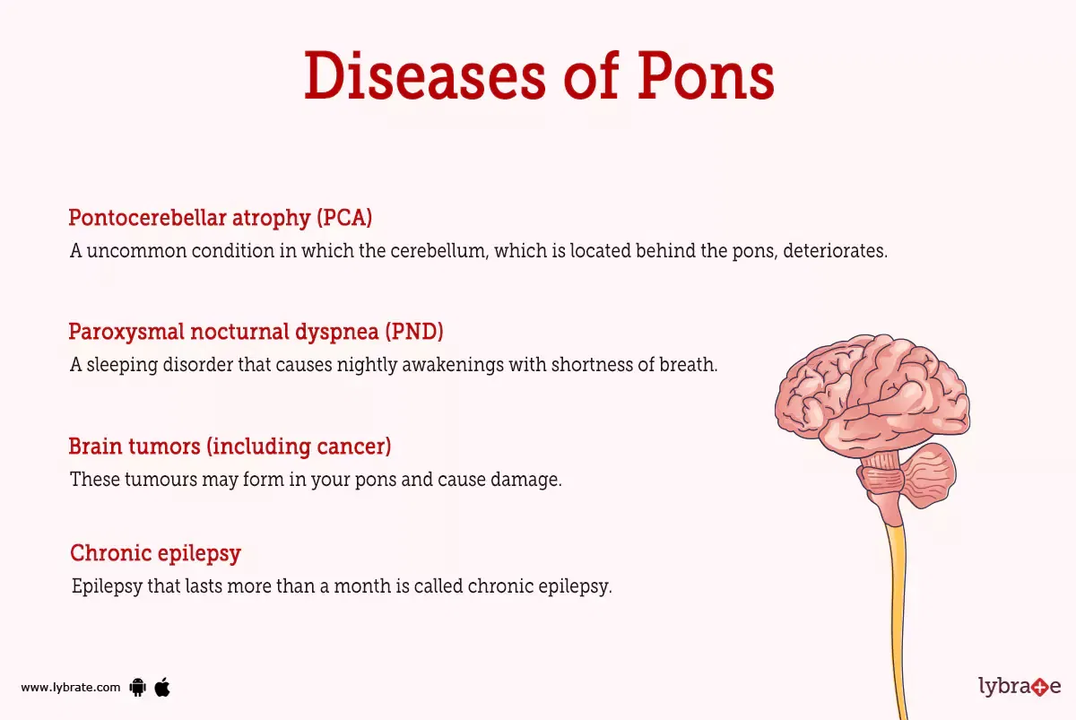 Pons human anatomy image functions diseases and treatments