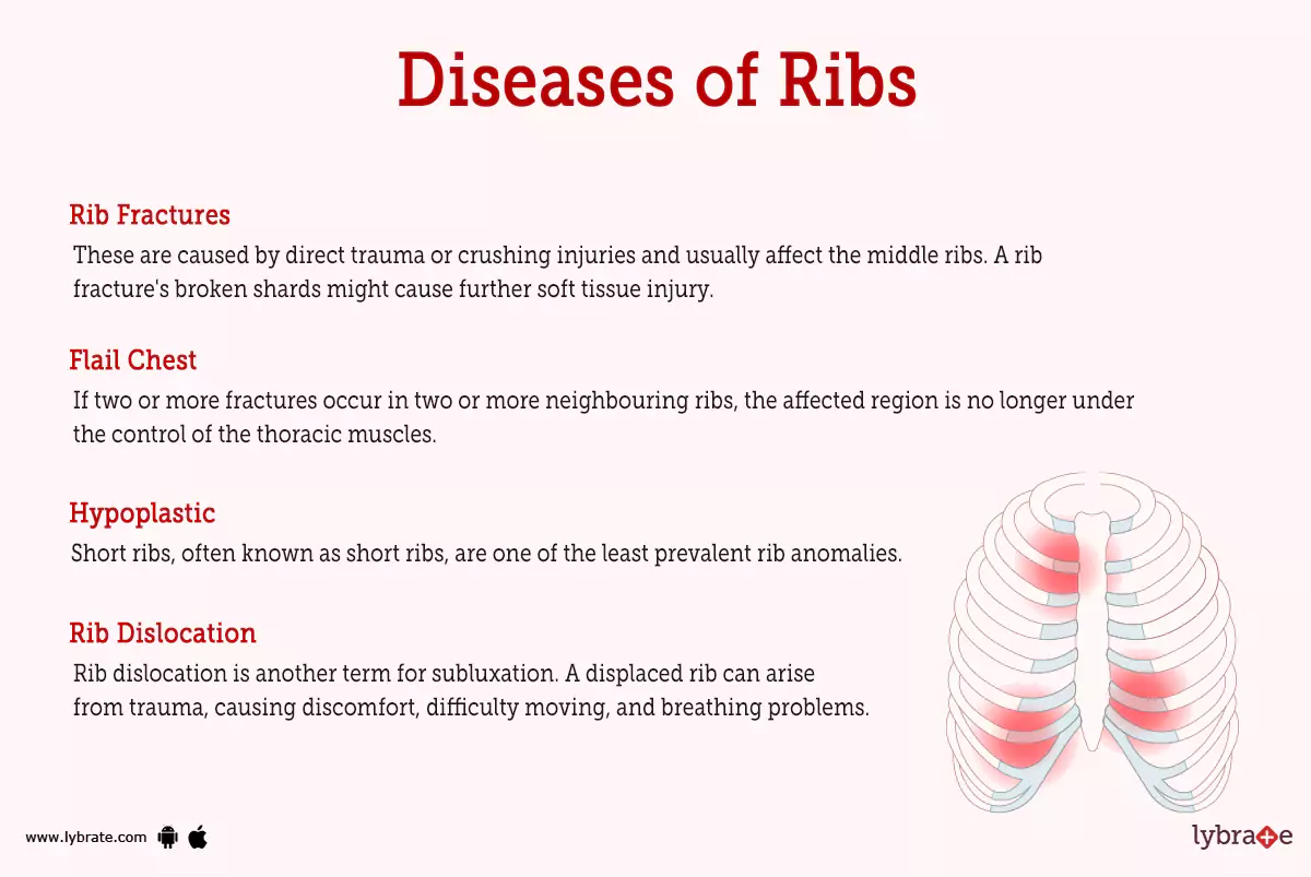 Ribs (Human Anatomy) Picture, Functions, Diseases, and Treatments