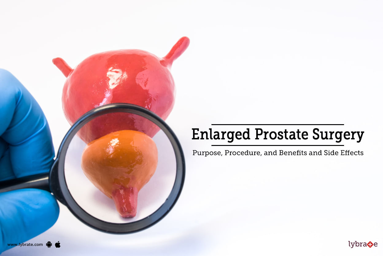 enlarged-prostate-surgery-purpose-procedure-benefits-and-side-effects