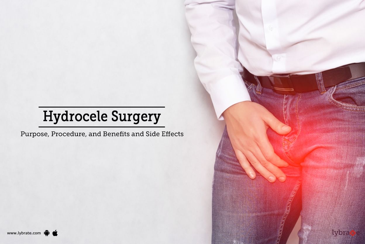 Hydrocele Treatment Procedure Cost Recovery Side Effects And More