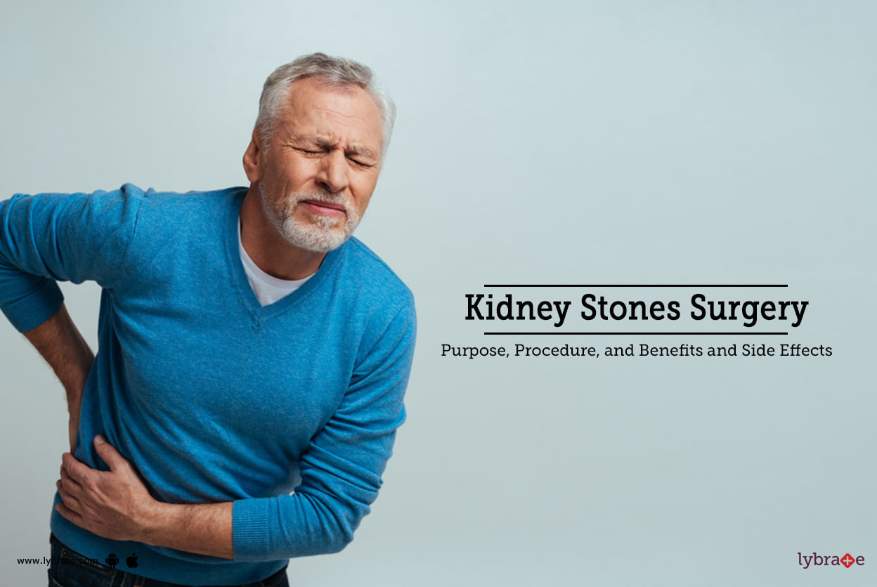 Kidney Stones Surgery: Purpose, Procedure, Benefits and Side Effects