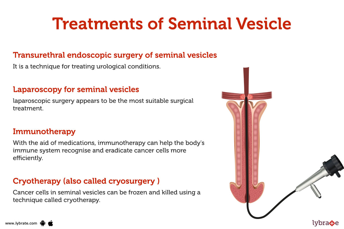 seminal-vesicle-human-anatomy-picture-functions-diseases-and